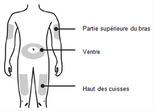 proc-dure-de-soin-injection-sous-cutan-e-0-18-ans-chuv-proc-dure